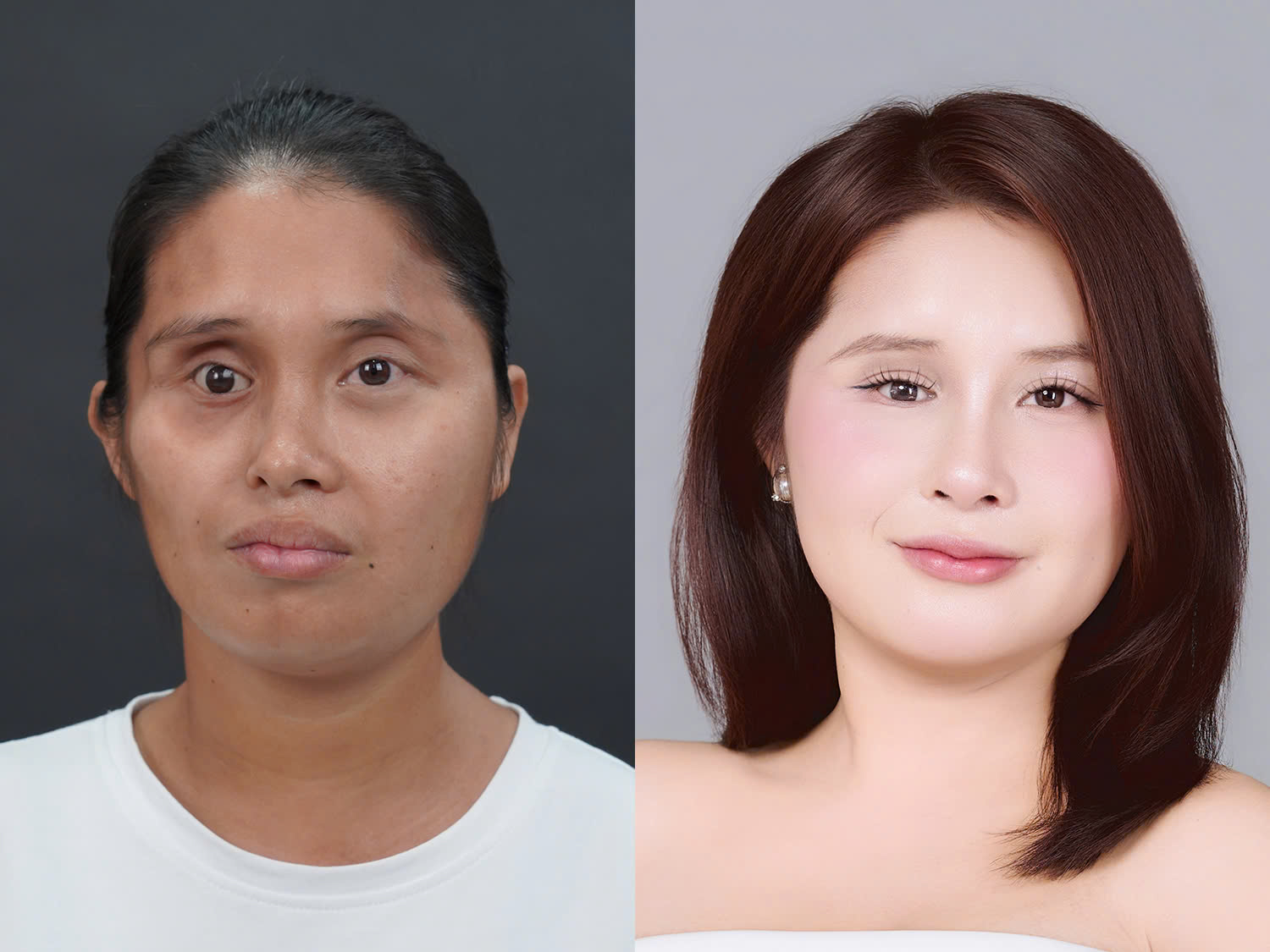 Yến trước và sau khi thay đổi ngoại hình, đôi mắt được bù thể tích, to tròn và cân đối với bên còn lại