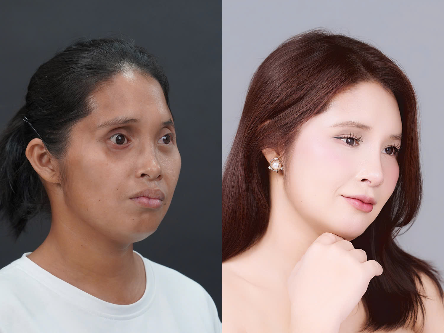 ảnh so sánh trước và sau khi lột xác, gương mặt của yến mềm mại theo mọi góc nhìn