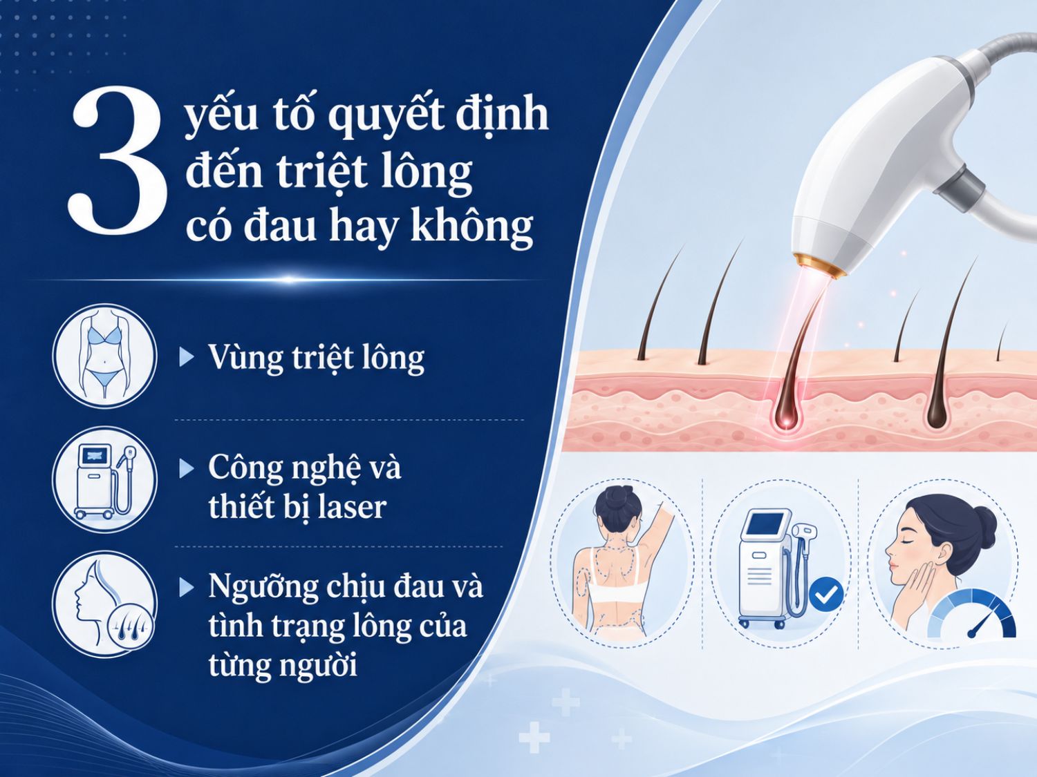 Cảm giác đau khi triệt lông phụ thuộc vào vùng điều trị, công nghệ laser sử dụng và cơ địa từng người. Những vùng nhạy cảm hoặc lông dày, sậm màu có thể gây châm chích rõ hơn, nhưng thiết bị có làm lạnh sẽ giúp giảm khó chịu.