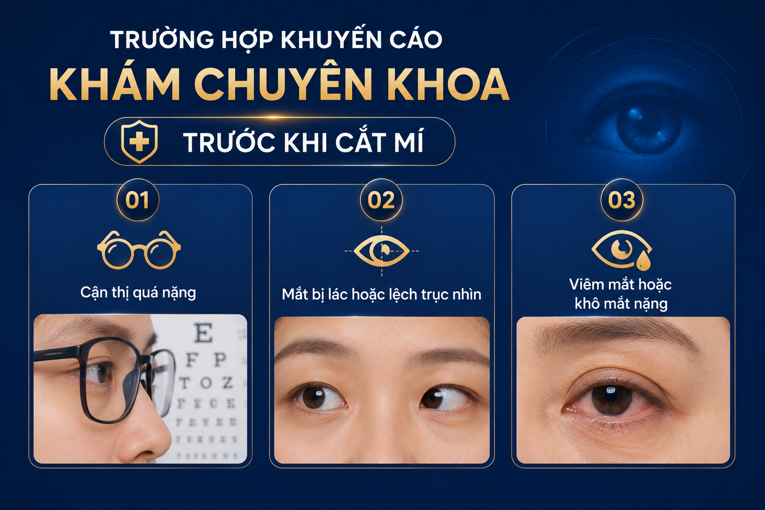 ảnh mô tả Một số trường hợp thường được khuyến cáo thăm khám chuyên khoa mắt trước khi cắt mí