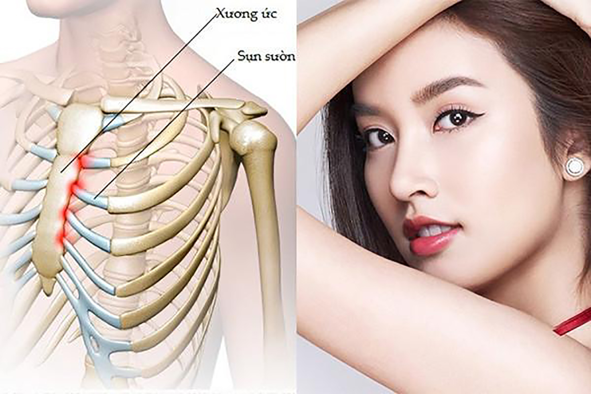 Sụn sườn được sử dụng để tái cấu trúc toàn bộ dáng mũi 