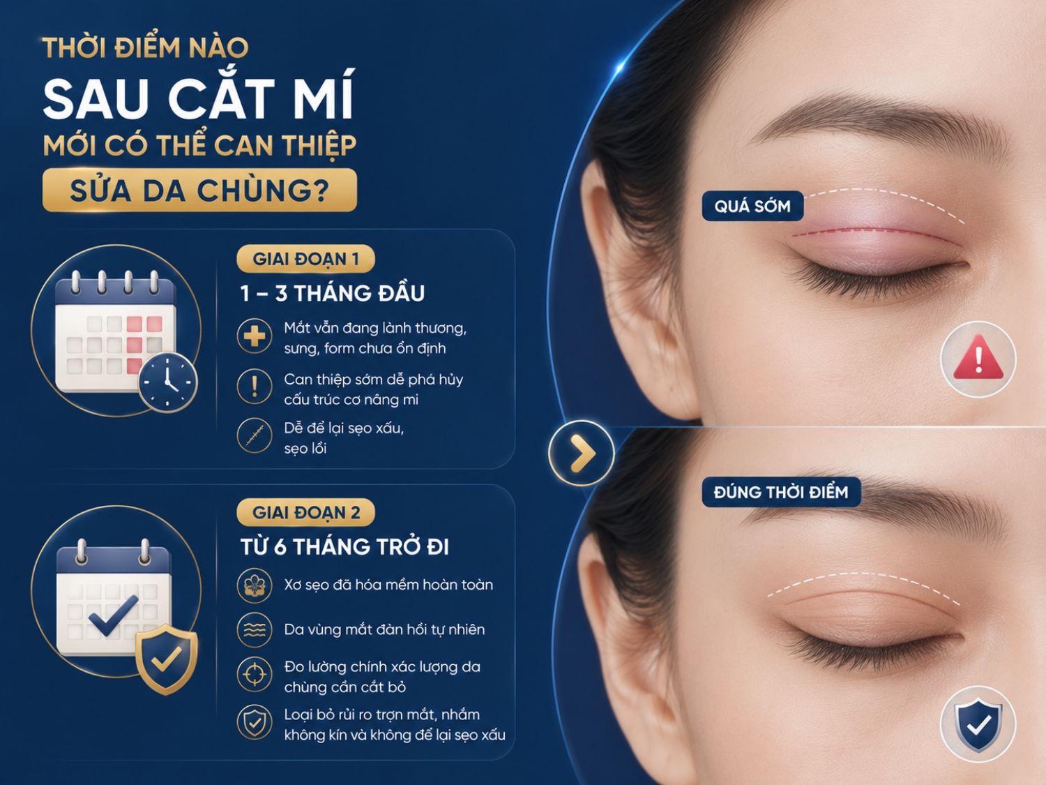 Các chuyên gia thường khuyến nghị chờ tối thiểu 6 tháng sau cắt mí trước khi sửa da chùng. Đây là thời điểm mô sẹo đã ổn định, da lấy lại độ đàn hồi và bác sĩ có thể đánh giá chính xác lượng da cần điều chỉnh để hạn chế biến chứng và sẹo xấu.