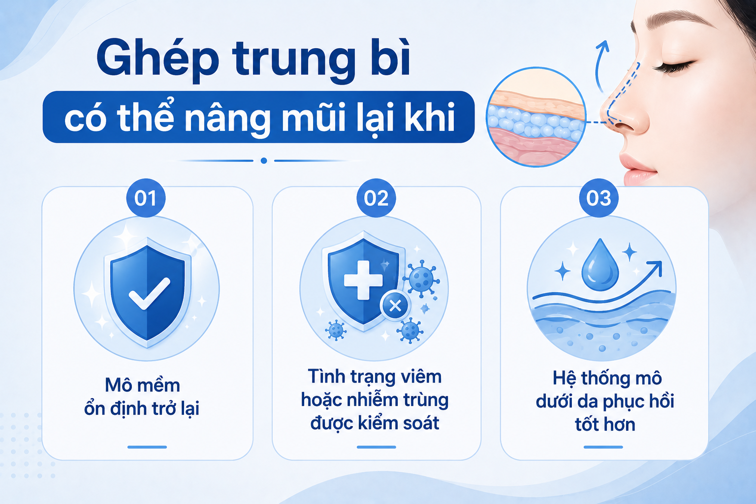 ảnh lý giải Sau ghép trung bì bao lâu thì có thể nâng mũi lại