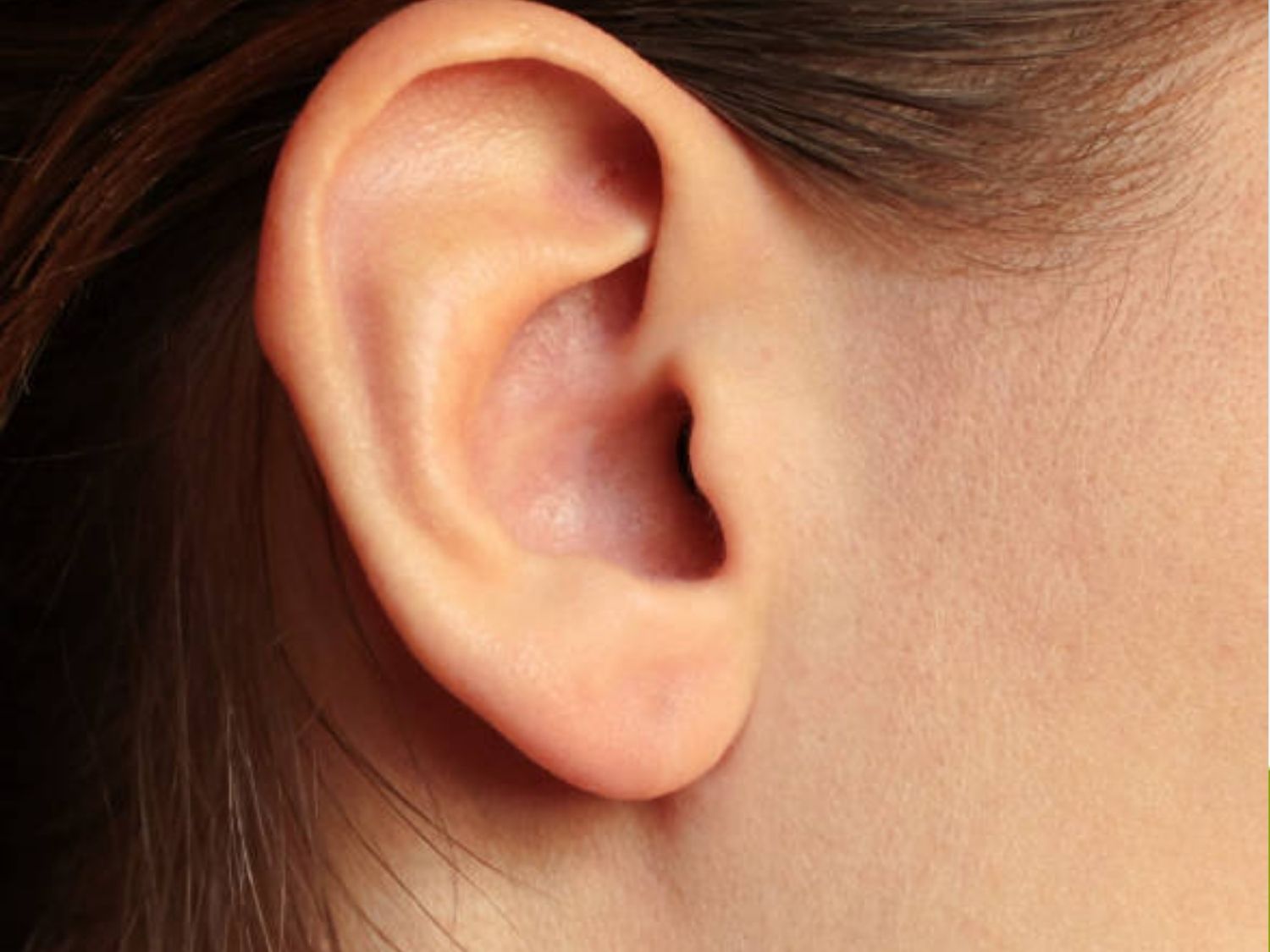 Sụn tai là một trong những loại sụn tự thân được lựa chọn phổ biến nhất khi nâng mũi