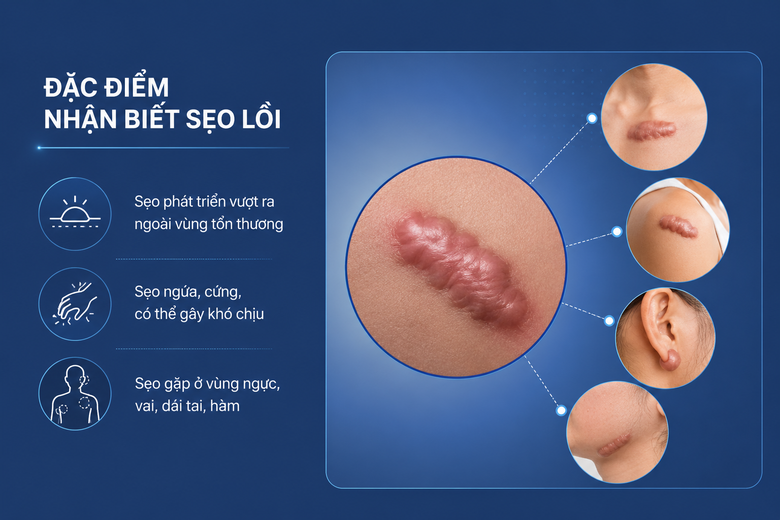 ảnh mô tả các đặc điểm nhận biết sẹo lồi