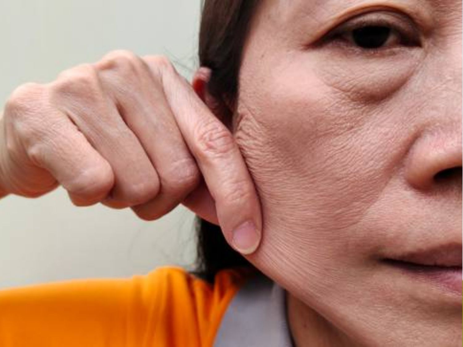 Hai bên má chùng cần cân nhắc thực hiện lại liệu trình hifu