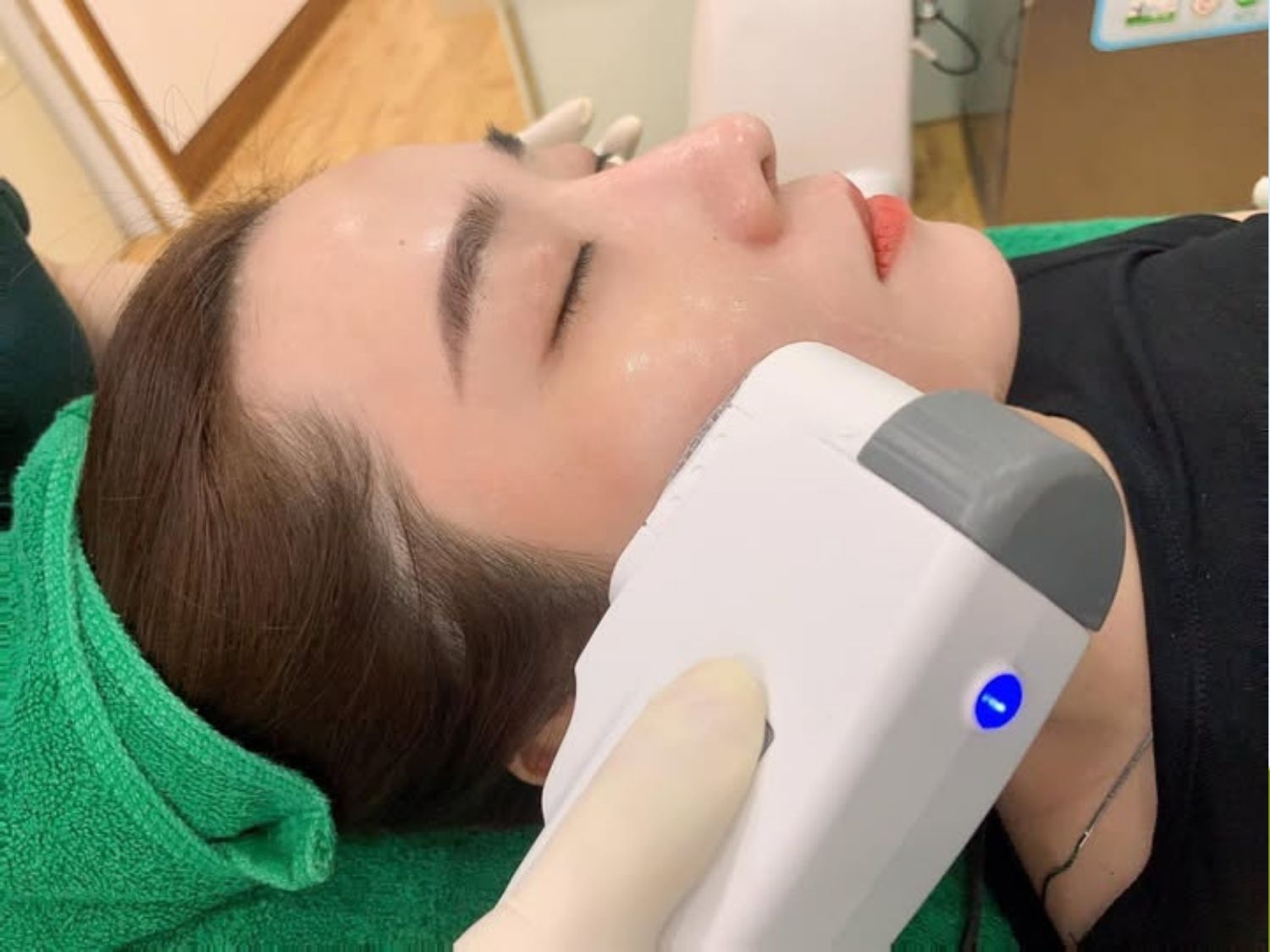 HIFU là công nghệ sử dụng sóng siêu âm hội tụ để truyền năng lượng xuống lớp mô dưới da nhằm kích thích tái tạo collagen