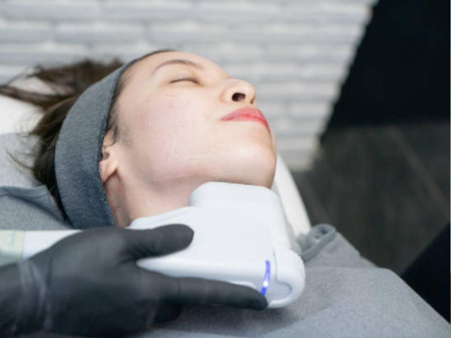 HIFU (High-Intensity Focused Ultrasound) sử dụng sóng siêu âm hội tụ cường độ cao tác động vào các lớp sâu dưới da