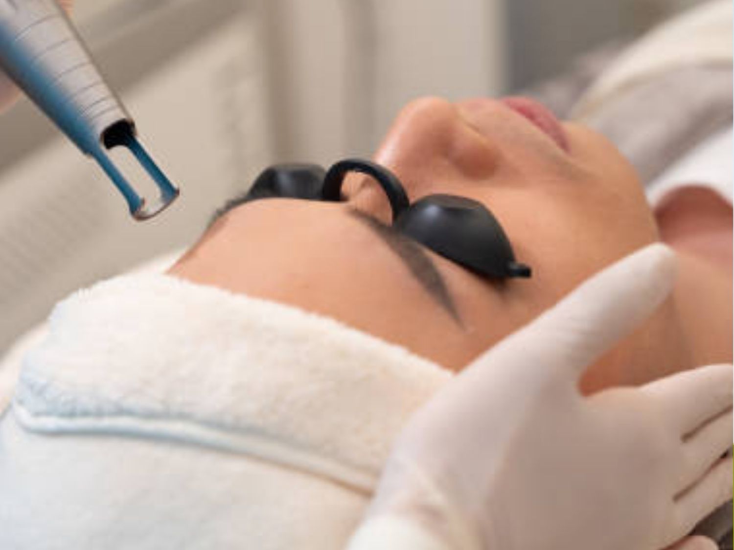 Cảm giác thực tế qua từng giai đoạn trị liệu Picosure Pro chỉ hơi châm chích