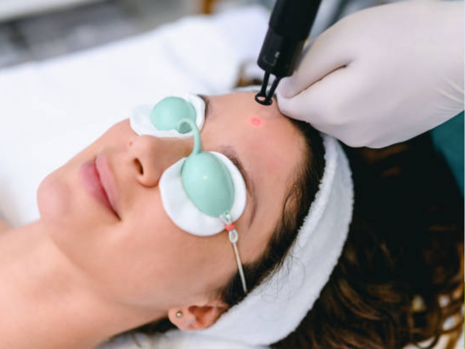 Laser Picosure Pro ít đau hơn khi tác động lên da