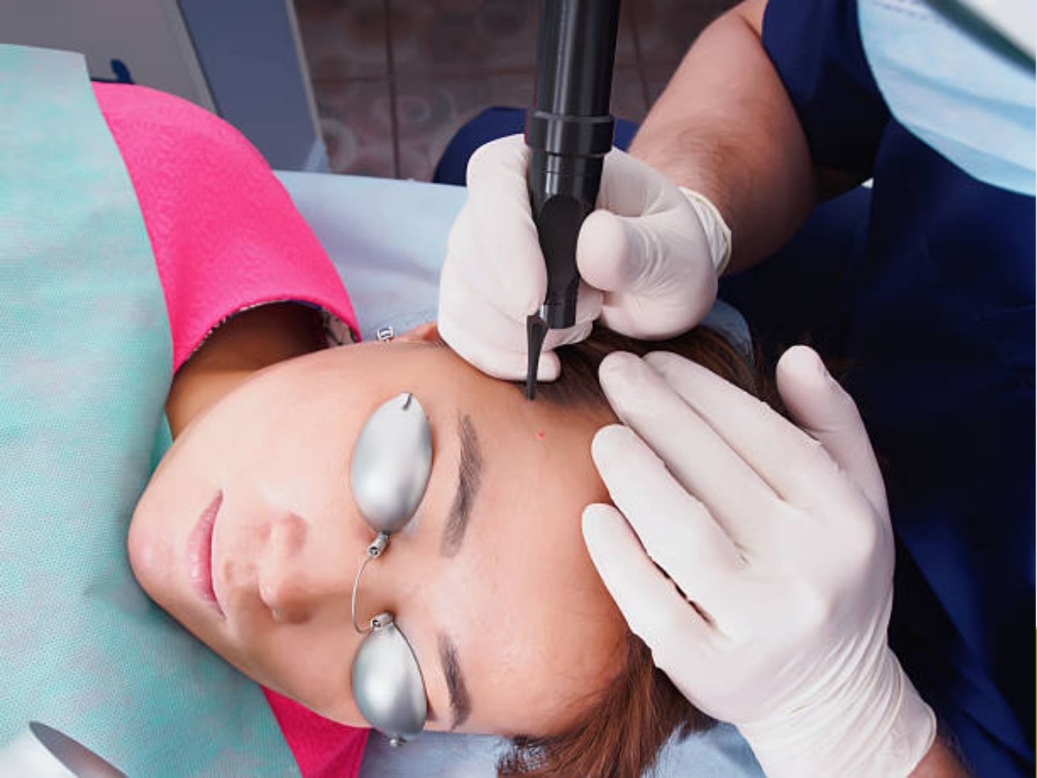 bác sĩ đi máy Laser Picosure Pro trên da mặt khách hàng