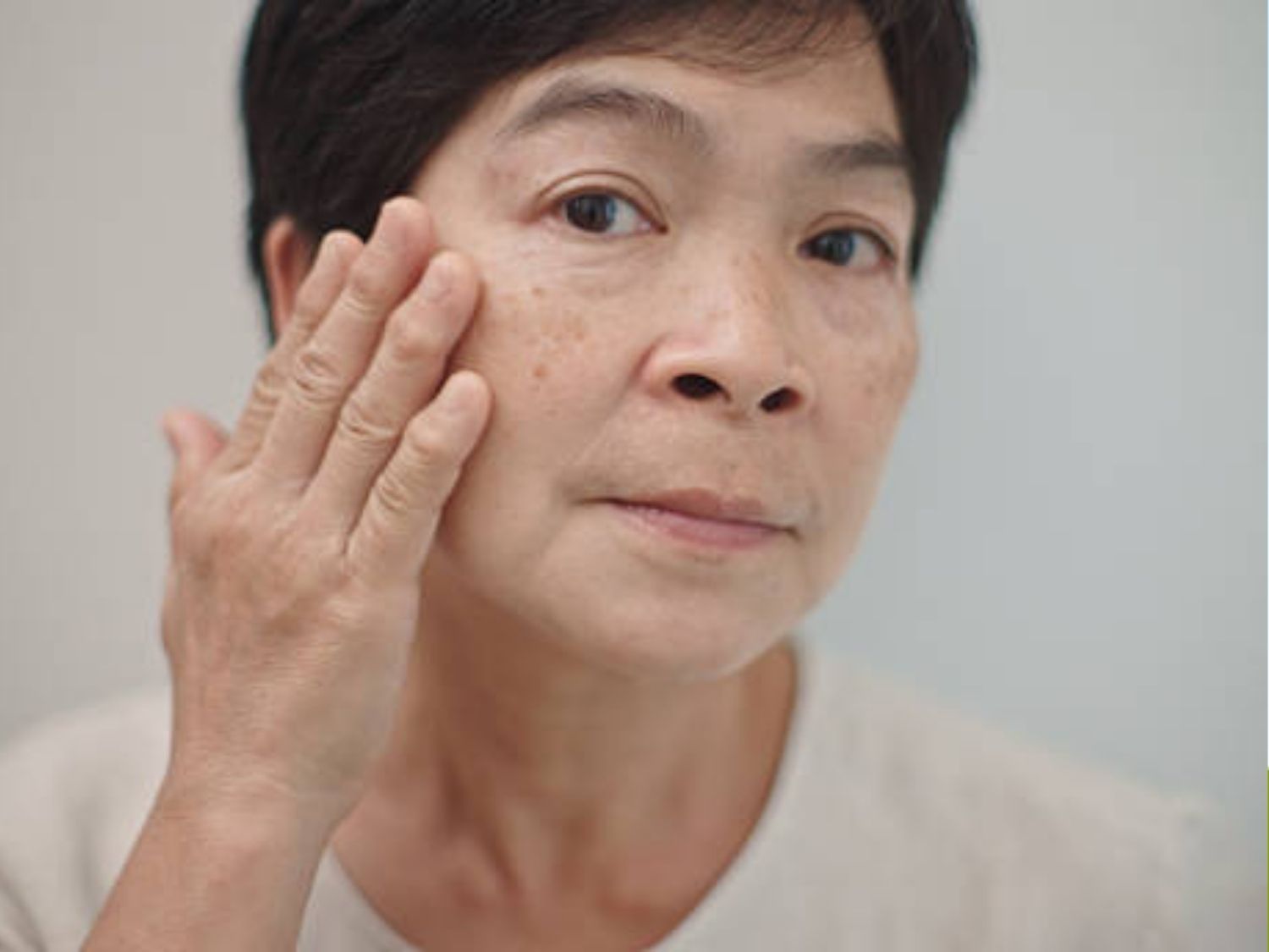 tình trạng khách da bắt đầu chùng nhão vùng má, đường viền hàm, nọng cằm