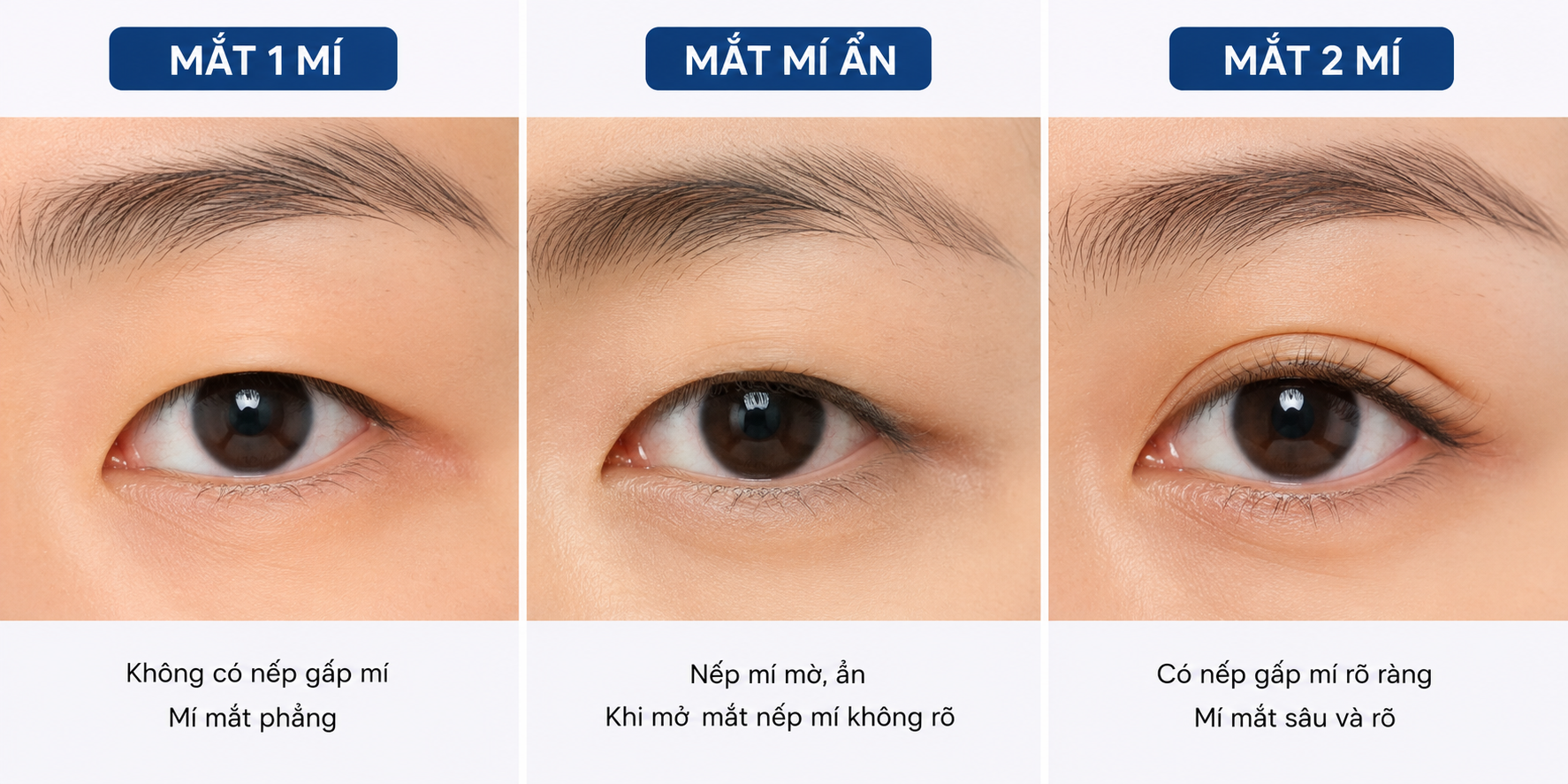 ảnh so sánh mắt 1 mí, 2 mí và mắt mí ẩn chi tiết