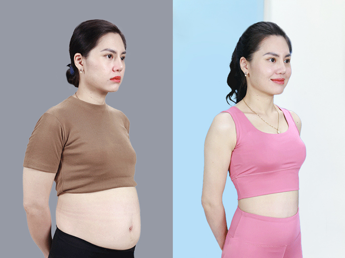 Hút mỡ vào tháng 7 âm không ảnh hưởng đến sức khỏe hay quá trình phục hồi