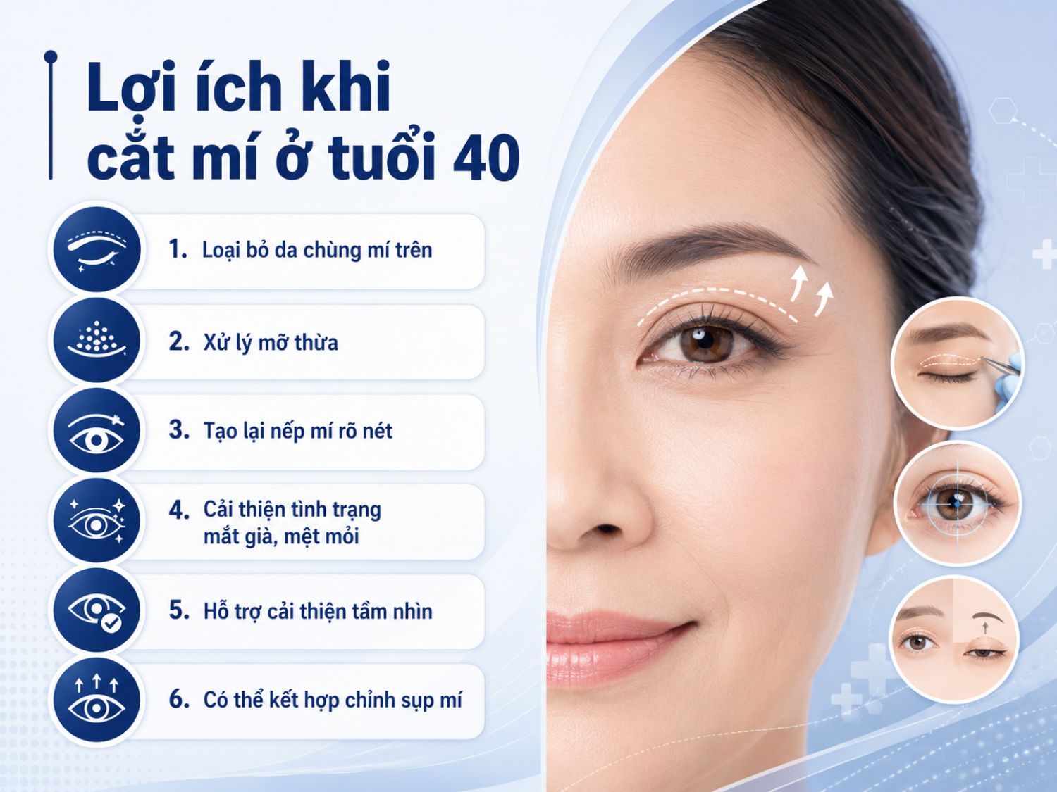 Cắt mí ở tuổi 40 có thể hỗ trợ xử lý da chùng, mỡ thừa, làm rõ nếp mí, cải thiện vẻ mệt mỏi và tầm nhìn; một số trường hợp có thể kết hợp chỉnh sụp mí.