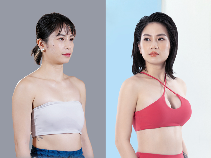 Frankie – Hot TikToker của Toki Family, đồng thời là huấn luyện viên Fitness trước và sau khi nâng ngực