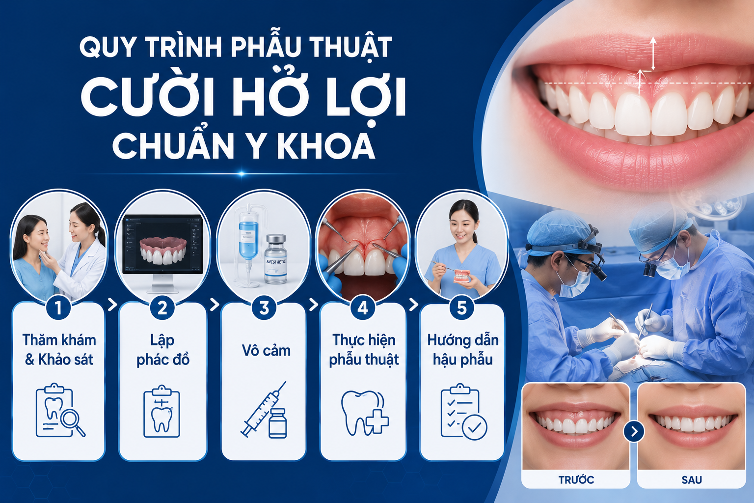 ảnh mô tả Quy trình phẫu thuật cười hở lợi chuẩn y khoa