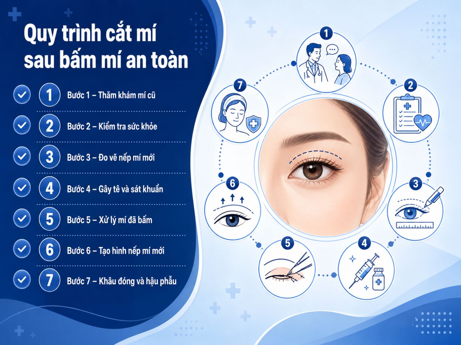 Cắt mí sau bấm mí cần thực hiện theo quy trình 7 bước chuẩn y khoa, từ đánh giá mí cũ, đo vẽ nếp mí mới, gây tê, xử lý mí đã bấm đến khâu đóng và chăm sóc hậu phẫu để đảm bảo an toàn và tối ưu kết quả.