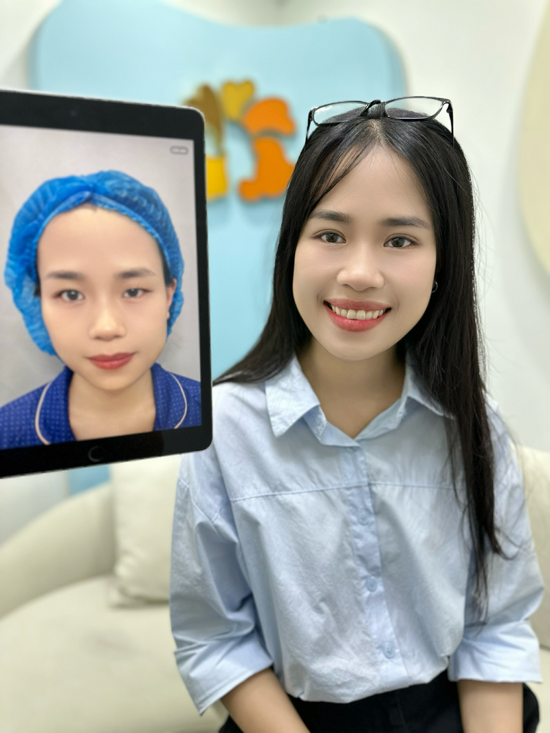 Thanh Trang sở hữu đôi mắt 2 mí to tròn, cân đối sau cắt mí tại Kangnam