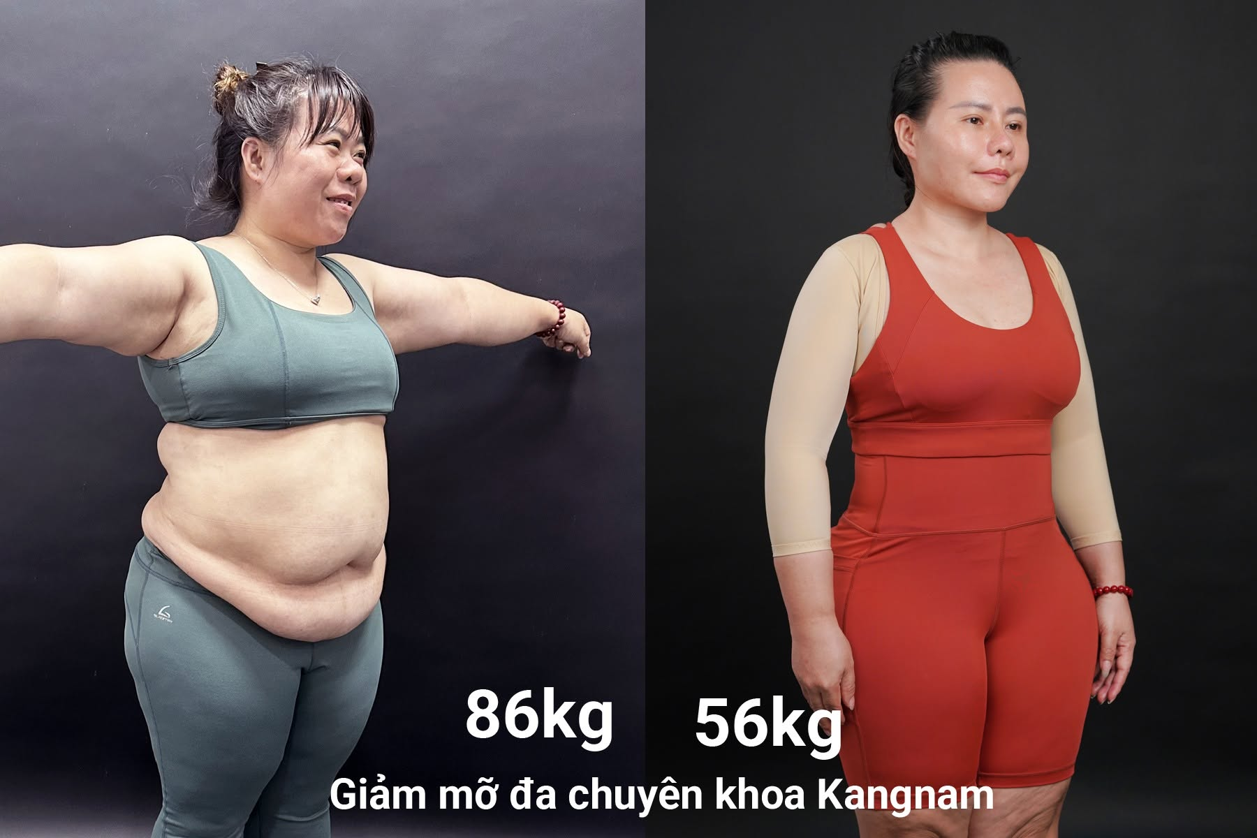 Chị Mai sở hữu bắp tay thon gọn, vòng eo cân đối sau khi giảm mỡ