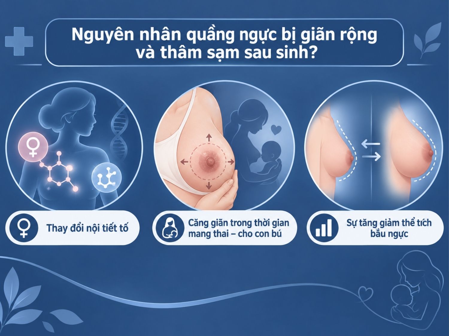Nguyên nhân quầng ngực bị giãn rộng gồm thay đổi nội tiết, căng giãn khi mang thai và giảm thể tích đột ngột sau sinh