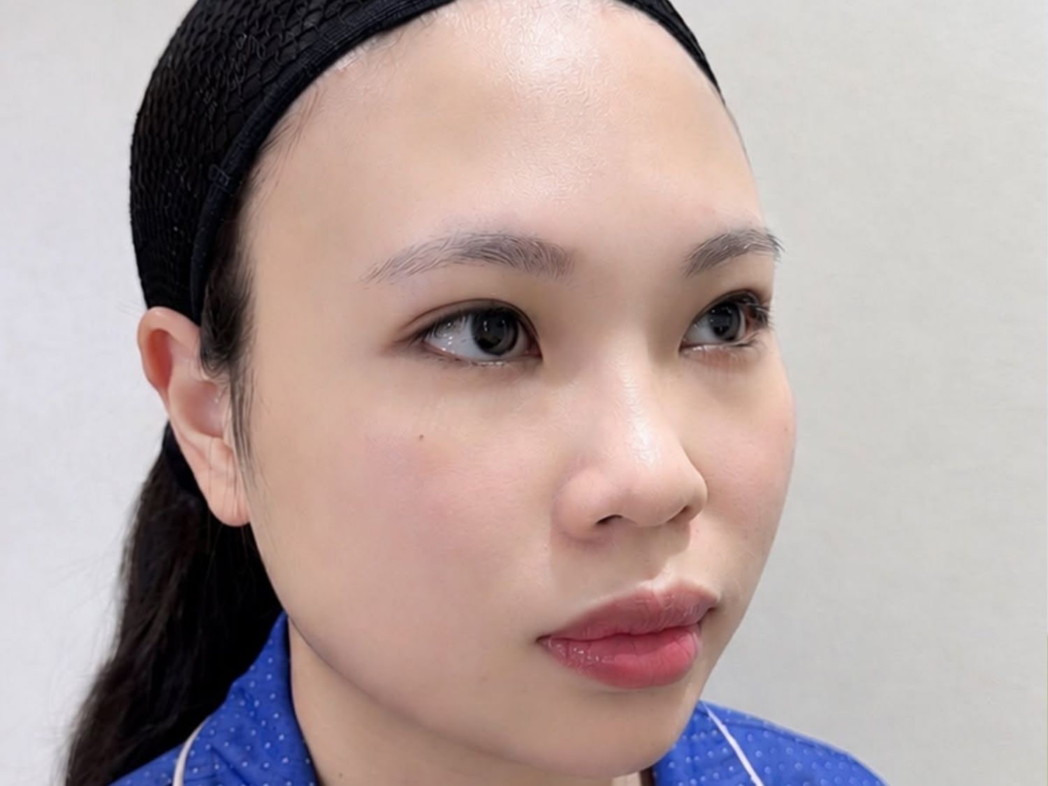 Đầu mũi to, tròn hoặc bè ngang của khách hàng