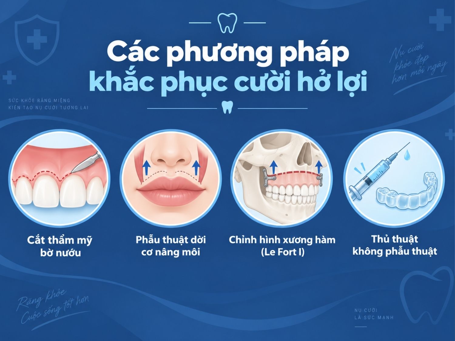 Các phương pháp khắc phục nụ cười hở lợi gồm cắt bờ nướu, dời cơ nâng môi, chỉnh xương hàm