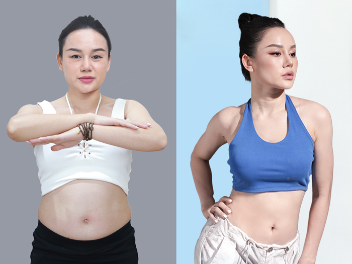 Kết quả giảm mỡ cần hướng đến sự cân đối của vùng bụng – eo, đồng thời đảm bảo an toàn và phù hợp với tình trạng cơ thể của từng khách hàng.