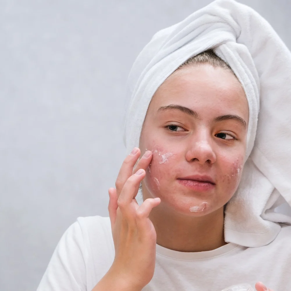 Sau các liệu trình tác động lên da, nên chăm sóc nhẹ nhàng, dưỡng ẩm và chống nắng đầy đủ; tránh tự cạy hoặc bóc lớp da đang bong để hạn chế kích ứng và tăng sắc tố.