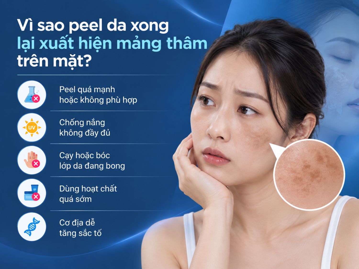 Mảng thâm sau peel có thể liên quan đến tình trạng tăng sắc tố sau viêm khi da bị kích ứng hoặc tổn thương. Peel không phù hợp, chống nắng kém, tự bóc da và sử dụng hoạt chất quá sớm đều có thể làm nguy cơ thâm sạm tăng lên.