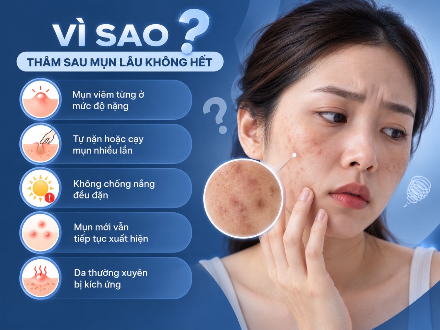 Thâm sau mụn có thể kéo dài khi tổn thương viêm ban đầu nặng, thường xuyên nặn hoặc cạy mụn, chống nắng không đầy đủ, mụn mới liên tục xuất hiện hoặc da bị kích ứng trong quá trình chăm sóc.