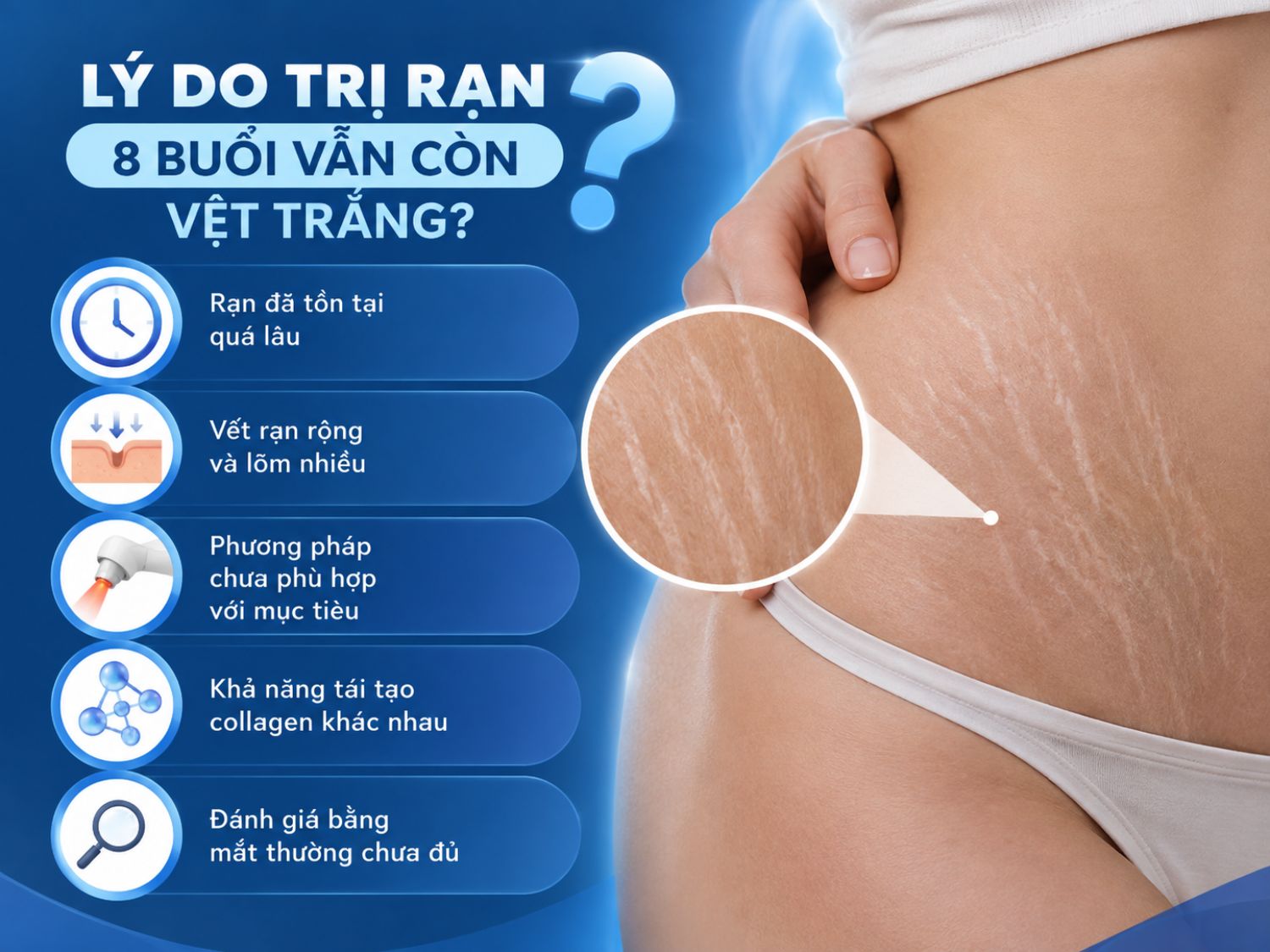 Vết rạn trắng có thể vẫn còn sau nhiều buổi điều trị khi rạn đã tồn tại lâu, tổn thương rộng hoặc lõm sâu, phương pháp chưa phù hợp với mục tiêu và khả năng tái tạo collagen của mỗi người khác nhau. Việc đánh giá kết quả nên dựa trên nhiều tiêu chí, không chỉ quan sát bằng mắt thường.