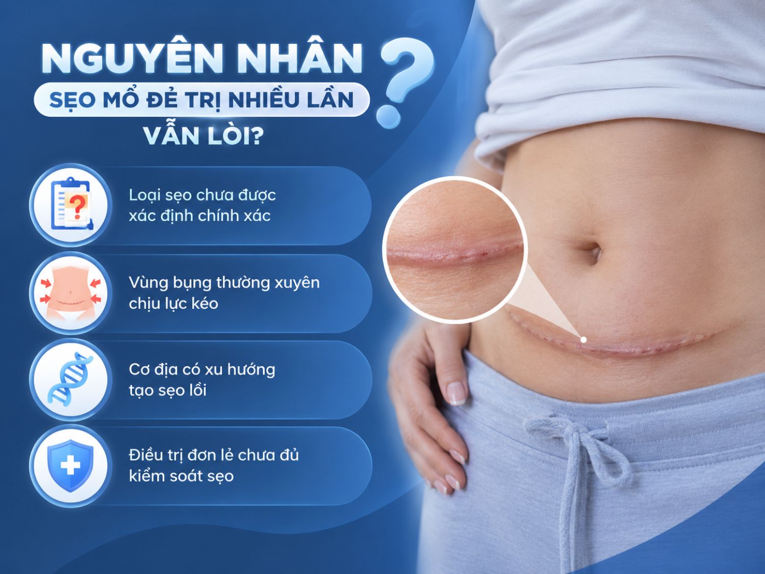 Sẹo mổ đẻ có thể vẫn lồi sau nhiều lần điều trị nếu chưa xác định đúng loại sẹo, vùng bụng thường xuyên chịu lực kéo, cơ địa dễ hình thành sẹo lồi hoặc chỉ áp dụng một phương pháp đơn lẻ chưa đủ kiểm soát sẹo.