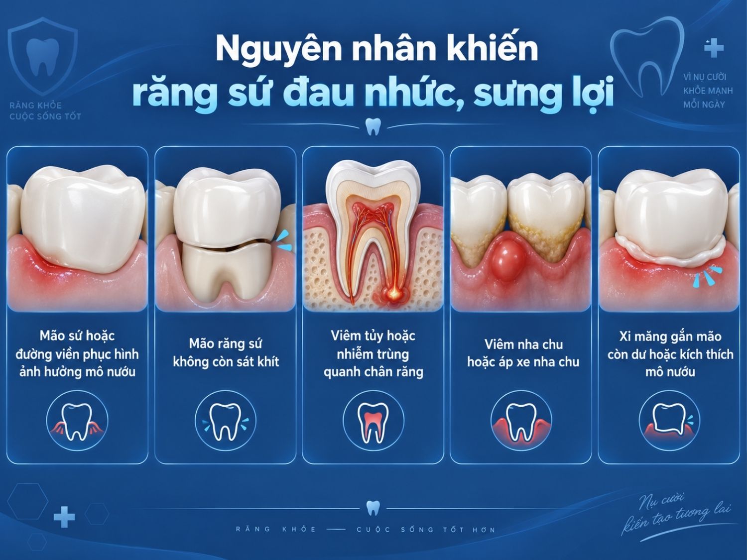 Nguyên nhân khiến răng sứ đau nhức, sưng lợi sau khi làm Mão sứ hoặc đường viền phục hình ảnh hưởng mô nướu, mão răng không khít