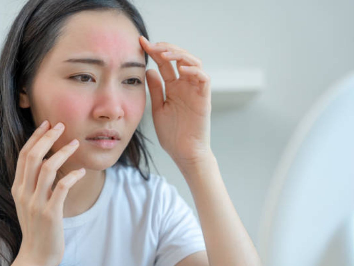 Da tổn thương nông, đỏ da