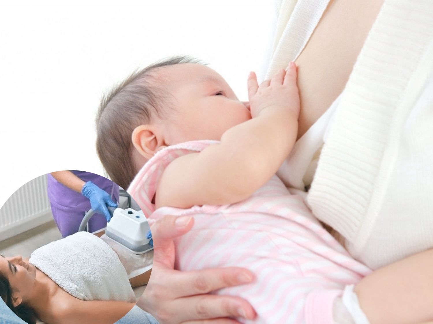Đang mang thai và cho con bú không nên sử dụng công nghệ giảm mỡ quá sớm