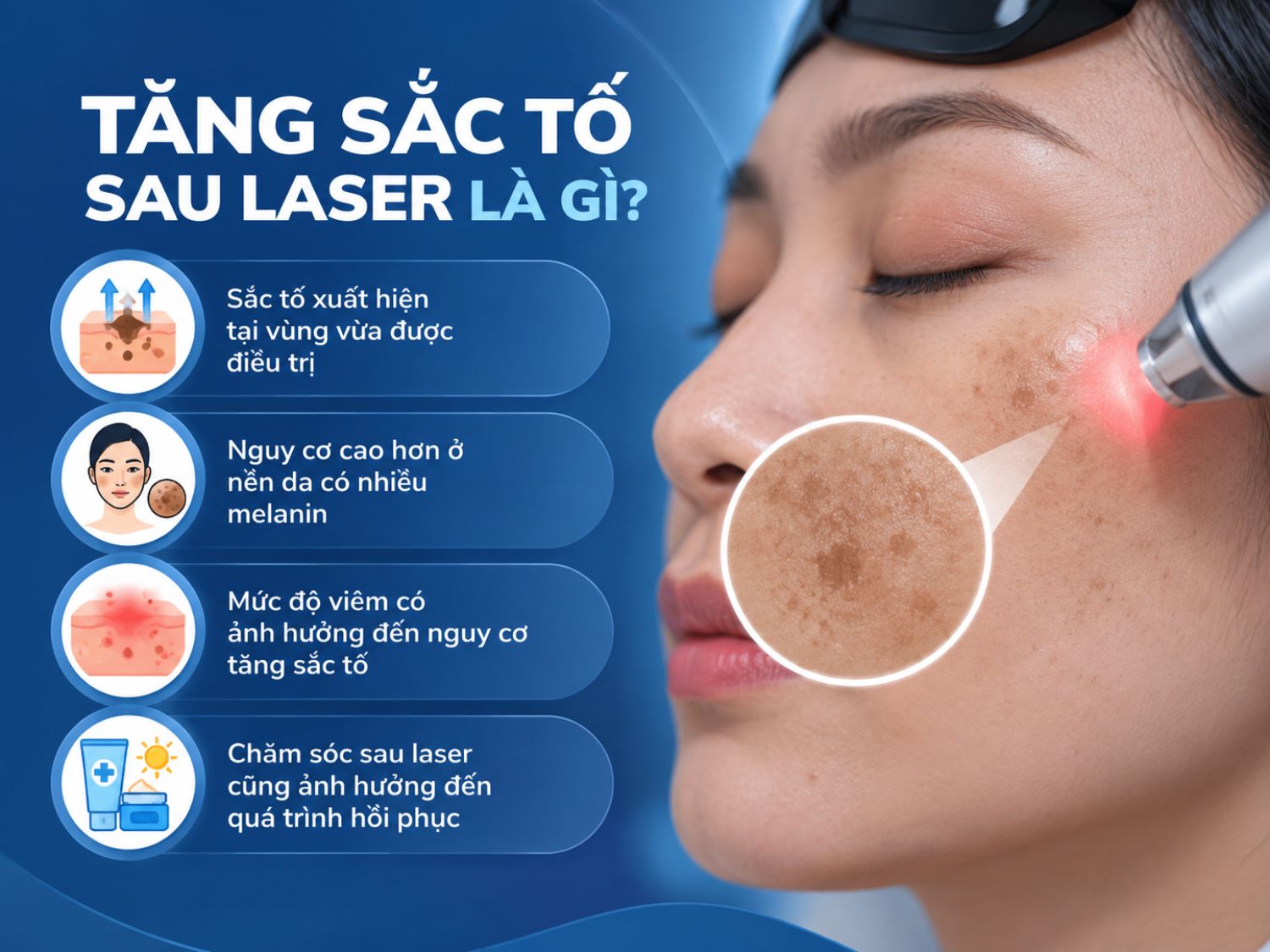 Tăng sắc tố sau laser có thể xuất hiện tại vùng da điều trị, đặc biệt ở nền da nhiều melanin hoặc khi phản ứng viêm mạnh. Chăm sóc và chống nắng đúng cách sau laser cũng đóng vai trò quan trọng trong quá trình phục hồi da.