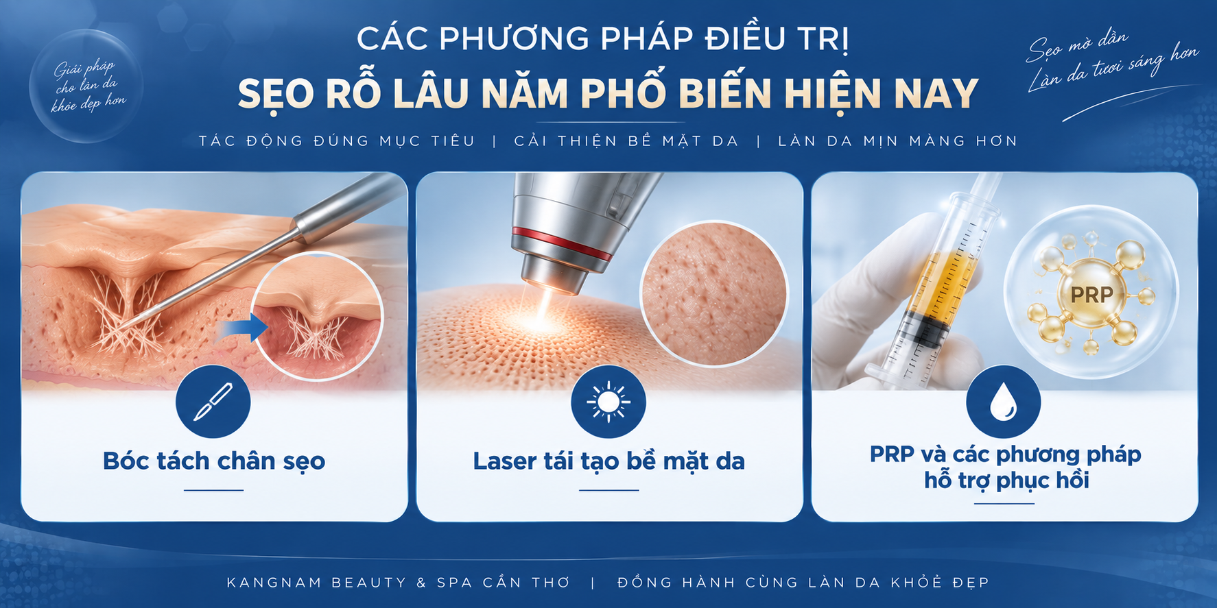 ảnh mô tả các phương pháp điều trị sẹo rỗ lâu năm phổ biến hiện nay