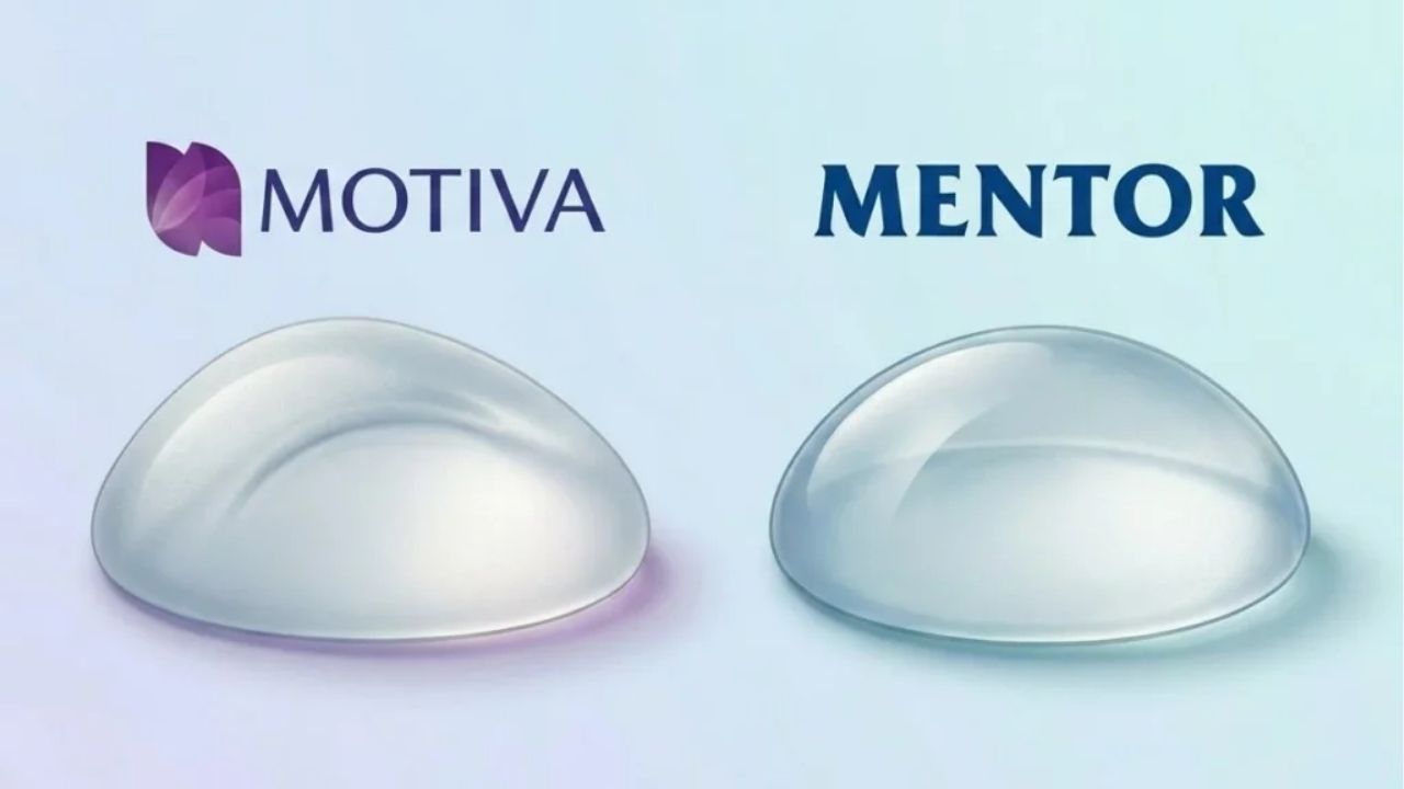 ảnh thực tế Túi ngực Motiva và Mentor