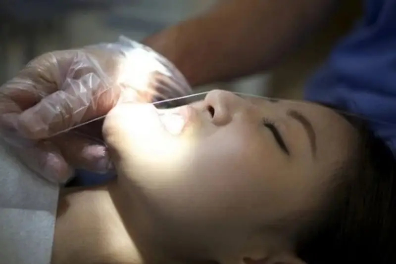 Gọt cằm có thể gây biến chứng nếu thực hiện sai kỹ thuật