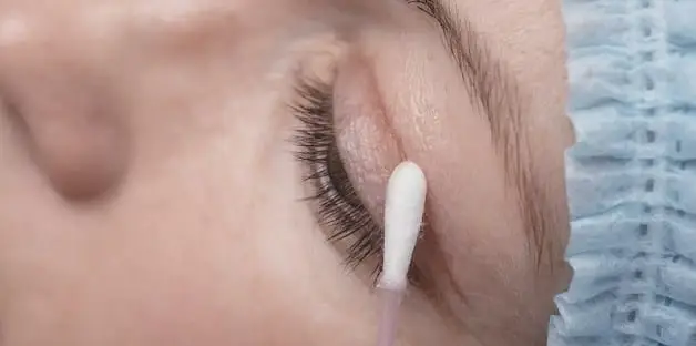 Việc vệ sinh mí mắt cũng là một trong những cách chăm sóc mí mắt sau khi cắt chỉ để phục hồi nhanh chóng và hiệu quả