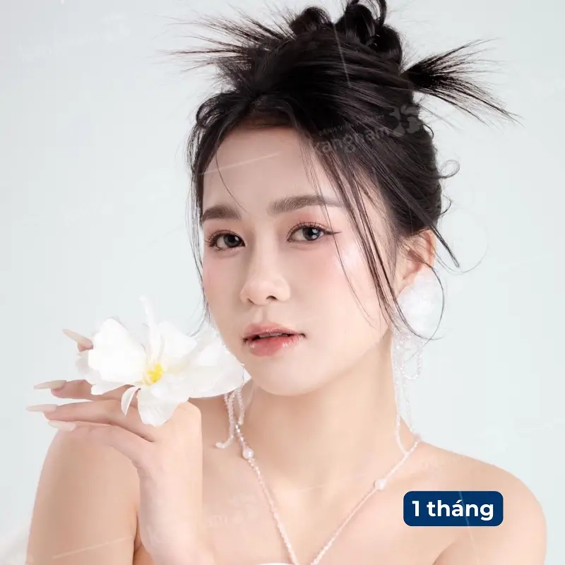 Sau 1 tháng nếp mí đã lành và rõ nét hơn