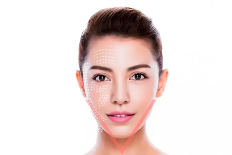 Giá độn cằm phụ thuộc vào vật liệu độn và phương pháp độn cằm