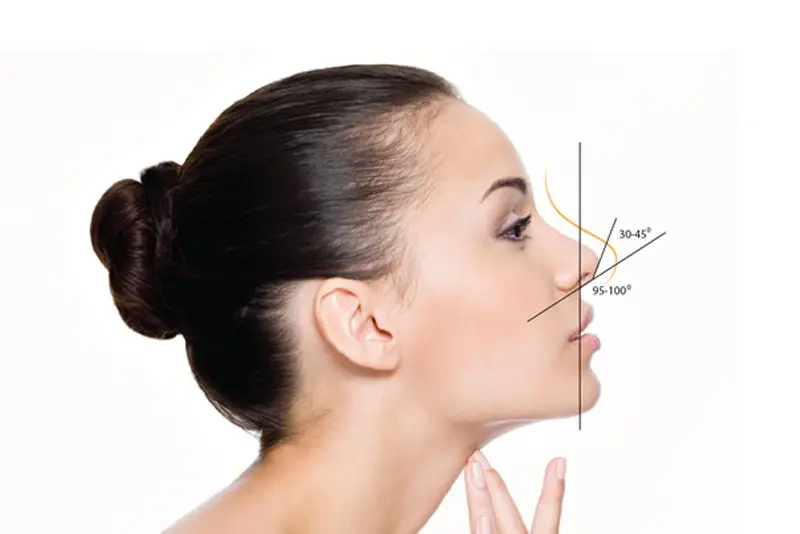 Nâng mũi Sline 3D mềm mại