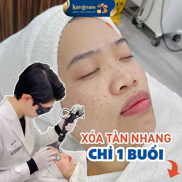 Bắn tàn nhang bởi bác sĩ có nhiều kinh nghiệm thường có chi phí nhỉnh hơn