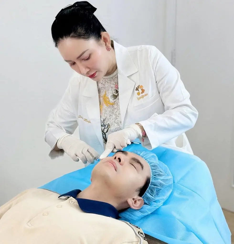 Tiêm filler rãnh cười đang là xu hướng làm đẹp nở rộ hiện nay