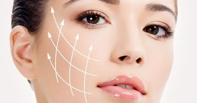 Chi phí căng chỉ rãnh cười rất đa dạng