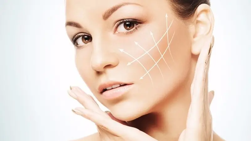 Căng chỉ rãnh cười sử dụng chỉ chuyên dụng để nâng đỡ vùng da chảy xệ