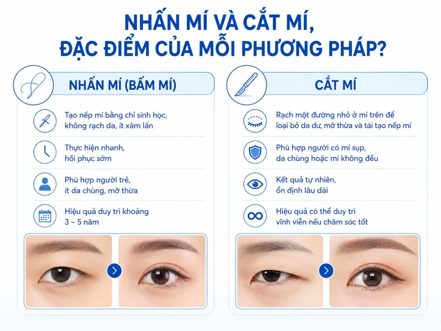 Phân biệt nhấn mí (ít xâm lấn, hồi phục nhanh, phù hợp người trẻ) và cắt mí (loại bỏ da chùng, mỡ thừa, hiệu quả lâu dài)