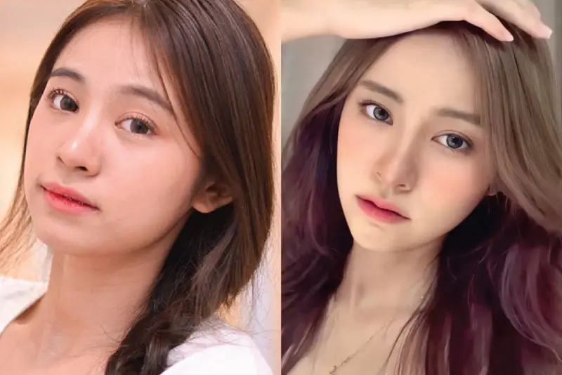 Chiếc cằm mới giúp gương mặt dài hơn, V-line sắc nét hơn